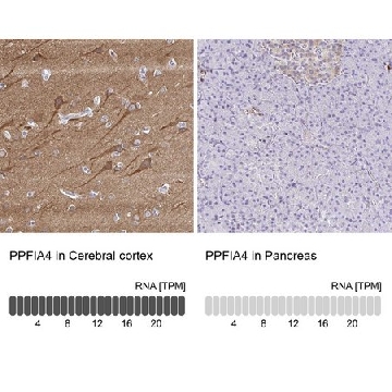 Anti-PPFIA4 antibody produced in rabbit，100UL，HPA053419-100UL，Sigma