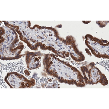 Anti-ACSL3 Antibody, clone 1I18 ZooMAb® Rabbit Monoclonal，4X25UL，ZRB2173-4X25UL，Sigma