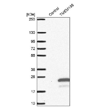 抗-TMEM138 兔抗，100UL，HPA042373-100UL，Sigma