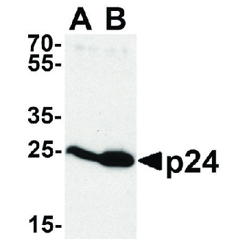 Anti-HIV-1 P24 antibody produced in rabbit，100UG，SAB3500946-100UG，Sigma