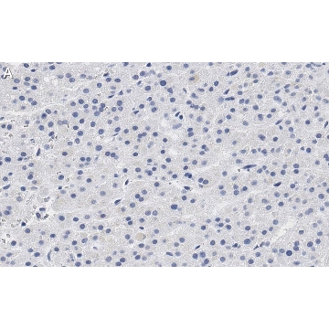 Anti-CXCR4 Antibody, clone 2L2, ZooMAb® Rabbit Monoclonal，25UL，ZRB1357-25UL，Sigma