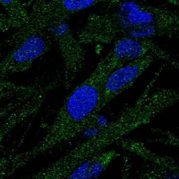 Anti-EPG5 antibody produced in rabbit，100UL，HPA031689-100UL，Sigma