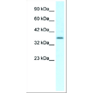 Anti-CMKLR1 antibody produced in rabbit，100UL，AV07056-100UL，Sigma