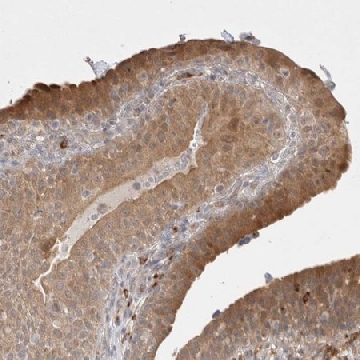Anti-GSDMB antibody produced in rabbit，100UL，HPA023925-100UL，Sigma