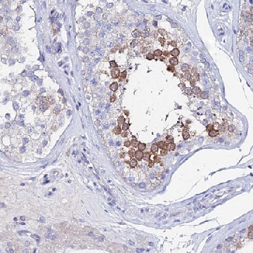 Anti-PTTG1 antibody produced in rabbit，100UL，HPA045034-100UL，Sigma