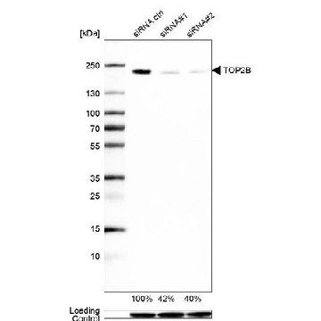 Anti-TOP2B antibody produced in rabbit，100UL，HPA024120-100UL，Sigma
