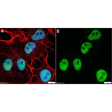 Anti-SV40 T Antigen Antibody, clone PAb416 ZooMAb® Mouse Monoclonal，25UL，ZMS1119-25UL，Sigma