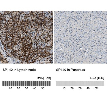 Anti-SP140 antibody produced in rabbit，100UL，HPA006162-100UL，Sigma