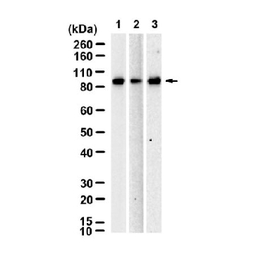Anti-IL1R1 Antibody, clone 2J18 ZooMAb® Rabbit Monoclonal，254G，ZRB3054-25UL，Sigma