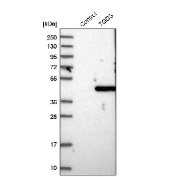 Anti-TGDS antibody produced in rabbit，100UL，HPA040857-100UL，Sigma