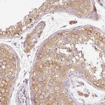 Anti-RNF167 antibody produced in rabbit，100UL，HPA049810-100UL，Sigma