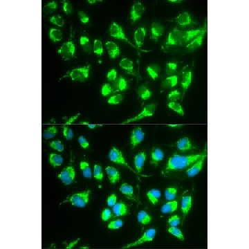 Anti-SLC22A5 antibody produced in rabbit，100UL，SAB4300885-100UL，Sigma