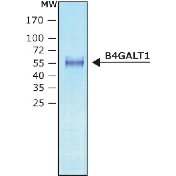 β-1,4-半乳糖基转移酶1，50UG，SAE0093-50UG，Sigma