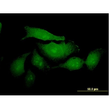 ANTI-MUC2 antibody produced in mouse，100UG，SAB1412598-100UG，Sigma