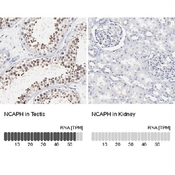 Anti-NCAPH antibody produced in rabbit，100UL，HPA002647-100UL，Sigma