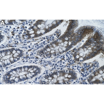Anti-VHL Antibody, clone 1C10 ZooMAb® Rabbit Monoclonal，25UL，ZRB2230-25UL，Sigma