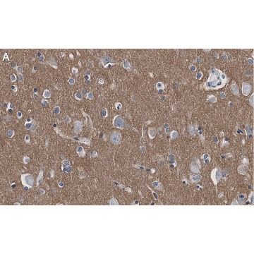 Anti-CD56 Antibody, clone 3F5 ZooMAb® Rabbit Monoclonal，25UL，ZRB1116-25UL，Sigma