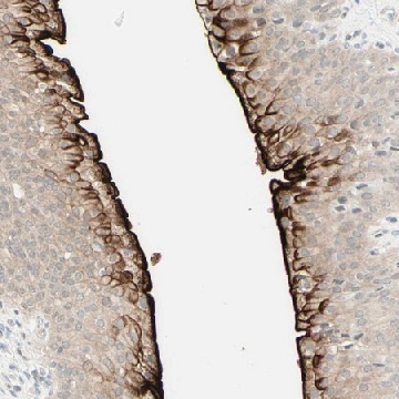 Anti-UPK3B antibody produced in rabbit，100UL，HPA010506-100UL，Sigma