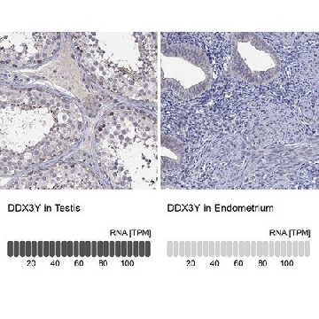Anti-DDX3Y antibody produced in rabbit，100UL，HPA059583-100UL，Sigma