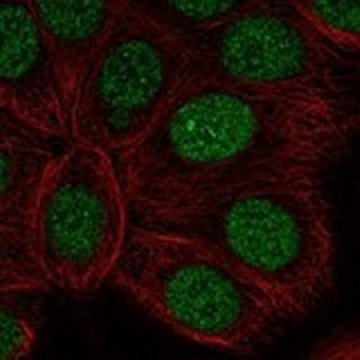 Anti-RARA antibody produced in rabbit，100UL，HPA071548-100UL，Sigma