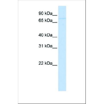 Anti-RNF43 antibody produced in rabbit，100UL，SAB2102033-100UL，Sigma