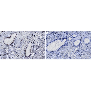 Anti-m3G/TMG cap Antibody, clone K121 ZooMAb® Mouse Monoclonal，254G，ZMS1229-25UL，Sigma