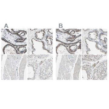 Anti-B4GALT1 antibody produced in rabbit，100UL，HPA010807-100UL，Sigma