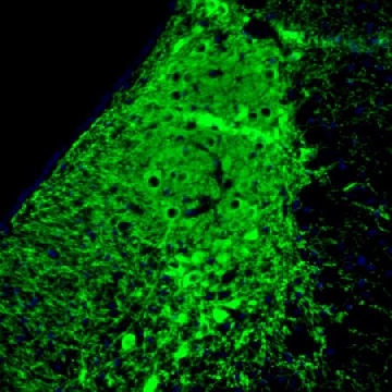Monoclonal Anti-SLC6A2 antibody produced in mouse，100UL，AMAB91116-100UL，Sigma