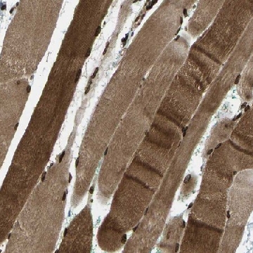 Anti-SYNE1 antibody produced in rabbit，100UL，HPA019113-100UL，Sigma
