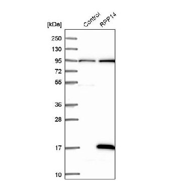 Anti-RPP14 antibody produced in rabbit，100UL，HPA036194-100UL，Sigma