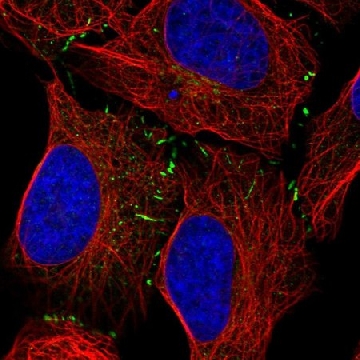 Anti-VPS13B antibody produced in rabbit，100UL，HPA043865-100UL，Sigma