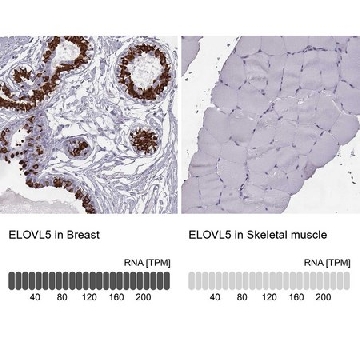 Anti-ELOVL5 antibody produced in rabbit，100UL，HPA047752-100UL，Sigma