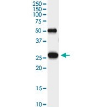 Monoclonal Anti-PGAM1 antibody produced in mouse，100UG，SAB1404195-100UG，Sigma