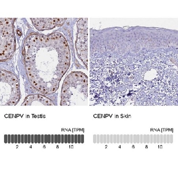 Anti-CENPV antibody produced in rabbit，100UL，HPA042616-100UL，Sigma