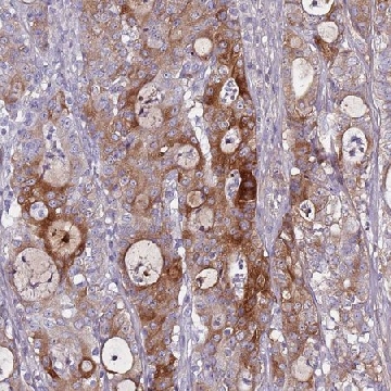 Anti-TNFRSF6B antibody produced in rabbit，100UL，HPA047154-100UL，Sigma