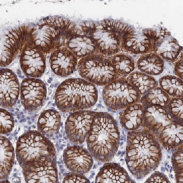 Anti-IL7 antibody produced in rabbit，100UL，HPA019590-100UL，Sigma