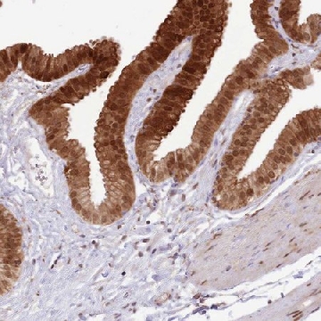 Anti-TRIM32 antibody produced in rabbit，100UL，HPA050060-100UL，Sigma