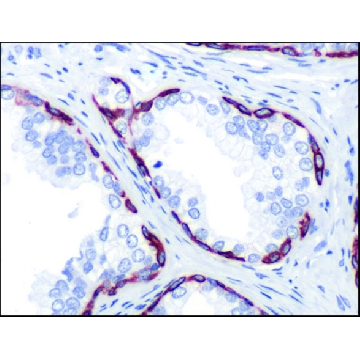 Anti-Keratin 14 antibody, Rabbit monoclonal，100UL，SAB5500124-100UL，Sigma