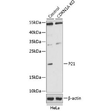 Anti-P21 antibody produced in rabbit，100UL，SAB5700189-100UL，Sigma