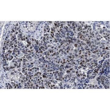 Anti-MDM2 Antibody, clone IF2 ZooMAb® Mouse Monoclonal，4X25UL，ZMS1041-4X25UL，Sigma