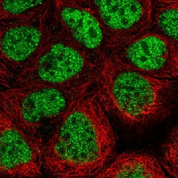 Anti-CDK8 antibody produced in rabbit，100UL，HPA044721-100UL，Sigma