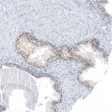 Anti-SP8 antibody produced in rabbit，100UL，HPA054006-100UL，Sigma