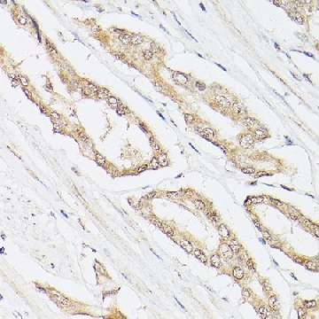 Anti-Pan Lactic acid-Lysine antibody produced in rabbit，100UL，SAB5701141-100UL，Sigma