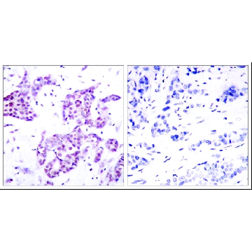 Anti-phospho-STAT6 (pTyr⁶⁴¹) antibody produced in rabbit，100UG，SAB4300038-100UG，Sigma