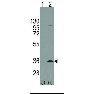 Anti-PARP16 (C-term) antibody produced in rabbit，100UG，SAB1300765-100UG，Sigma