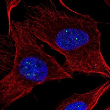 Anti-NPAT antibody produced in rabbit，100UL，HPA066370-100UL，Sigma