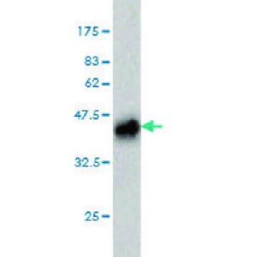 Monoclonal Anti-PLAG1 antibody produced in mouse，100UG，WH0005324M2-100UG，Sigma