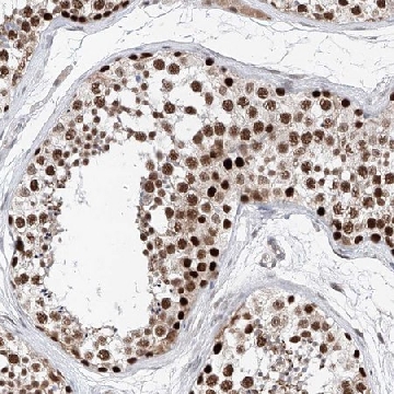Anti-SNRNP200 antibody produced in rabbit，100UL，HPA029321-100UL，Sigma