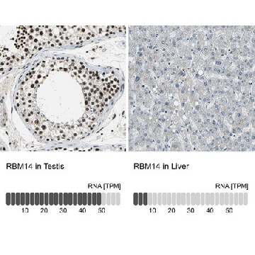 Anti-RBM14 antibody produced in rabbit，100UL，HPA006628-100UL，Sigma