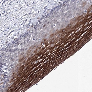Anti-ACOX3 antibody produced in rabbit，100UL，HPA035841-100UL，Sigma